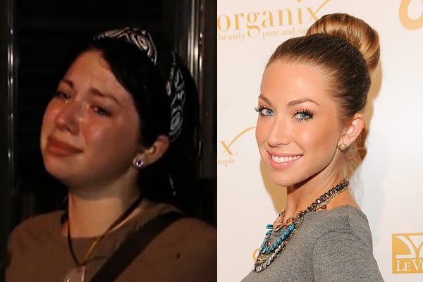 Stassi Schroeder Reveals Her Plastic Surgery Past